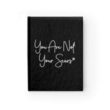 Journal - You Are Not Your Scars®