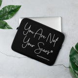 Laptop Sleeve - You Are Not Your Scars®
